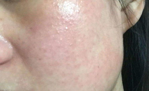 ��ҽ��������ư���� ����רҵ�ΰ���ҽԺ�ĸ���