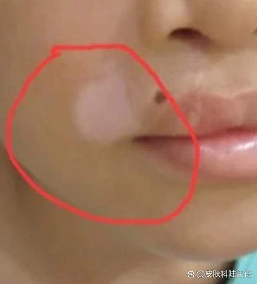 �人רҵ�ΰ����ҽԺ �沿���ư�����Ҫ�೤��ʱ��