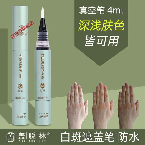 �������Ʒ��� ���������ư���