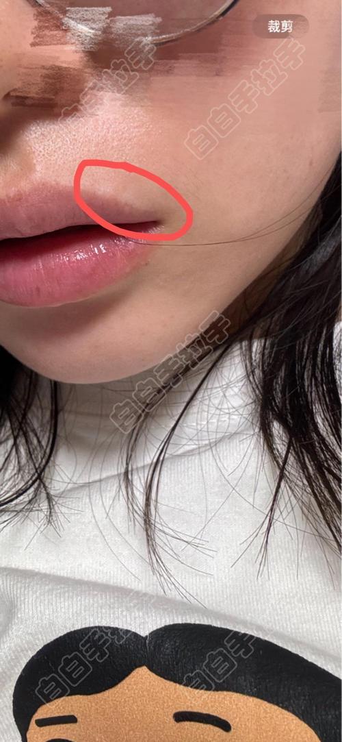 白癜风还有良性恶性之分吗 湛江更好治疗白癜风的医院 白癜风还有良性恶性之分吗 湛江更好治疗白癜风的医院