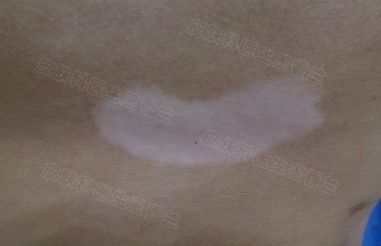 ļҽԺεú ΪʲôͯķʱȽϸ