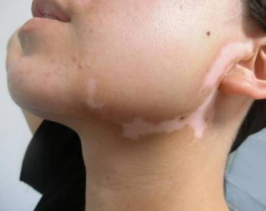 光速跑者21号粤语版 光速跑者21号粤语版