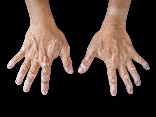 ��ͨ�ļ�ҽԺ�����ΰ��� ���绹�����Զ���֮����