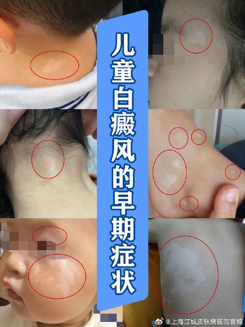 ʲô��ҩ���ư����