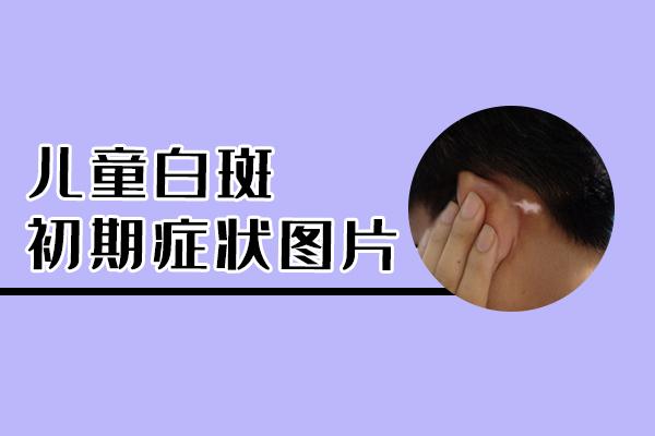 火影者游戏 火影忍者游戏佐助 火影者游戏 火影忍者游戏佐助