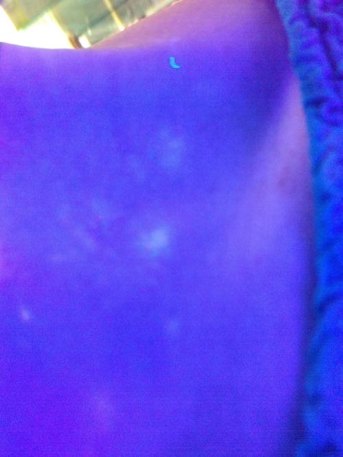 ���ڰ���ҽԺ��� ���ڿ�����Ĵ�ҽԺ