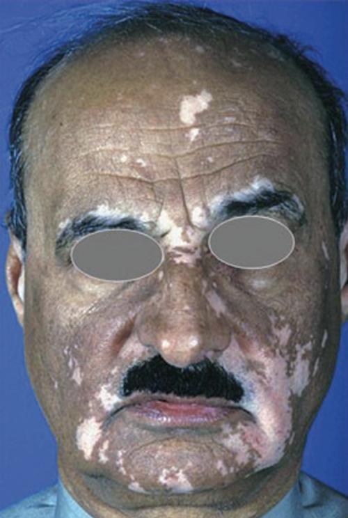 �ϰ�ȥ���� �ϰ�ȥ����������