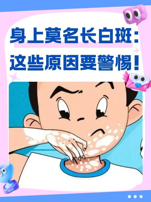 痤疮检查_痤疮检查内分泌有用吗 痤疮检查_痤疮检查内分泌有用吗