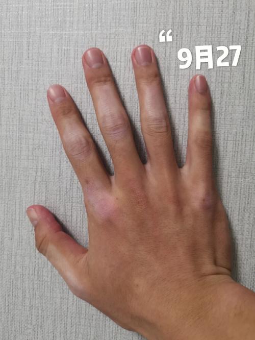 ���ݰ���ҽԺ����ԤԼ ����Ͱ���ĳ�����ʲô