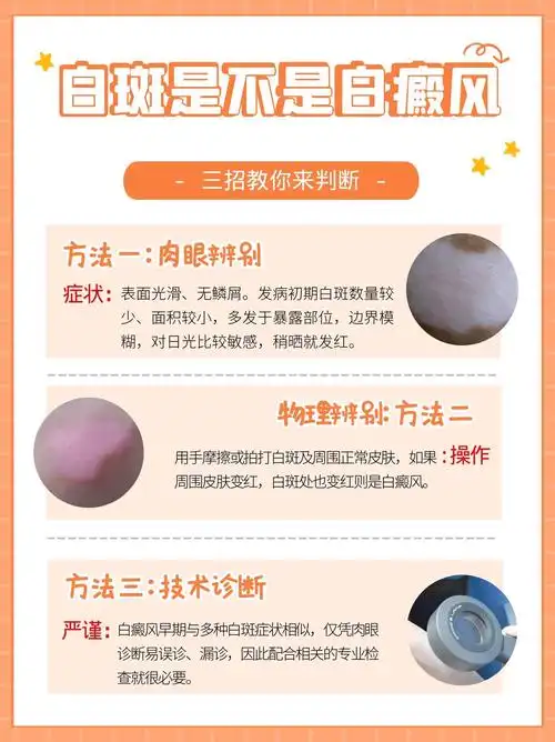 白癜风散发型的症状与日常护理要点解析 2025版 白癜风散发型的症状与日常护理要点解析 2025版