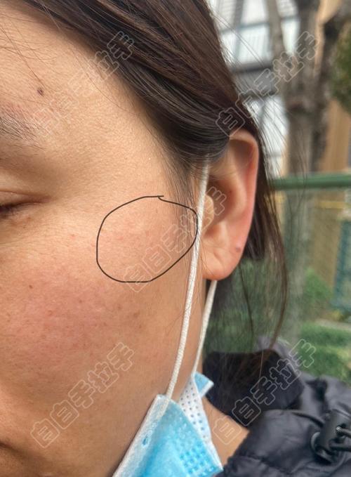 兰州主治白癜风的医院 兰州主治白癜风的医院