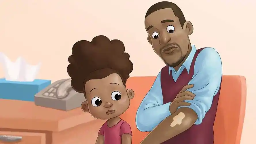 临沂哪个医院治白癜风专业 小儿白癜风能治好吗 临沂哪个医院治白癜风专业 小儿白癜风能治好吗