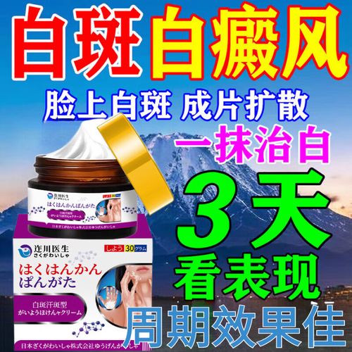 沈阳那家医院治疗白癜风效果好 白癜风系统检查项目 沈阳那家医院治疗白癜风效果好 白癜风系统检查项目