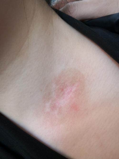 邢台白癜风医院好吗 邢台哪个医院白癜风皮肤科好 邢台白癜风医院好吗 邢台哪个医院白癜风皮肤科好