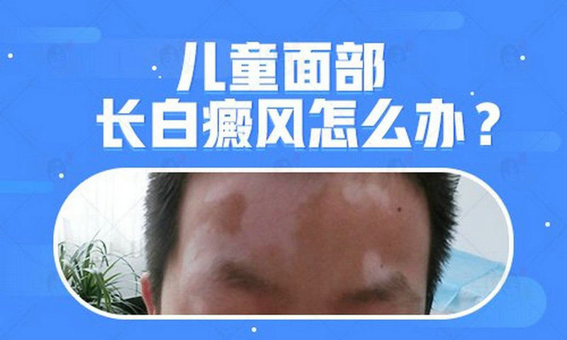 白癜风怎么治疗有效 南京治疗白癜风的医院哪家好 白癜风怎么治疗有效 南京治疗白癜风的医院哪家好