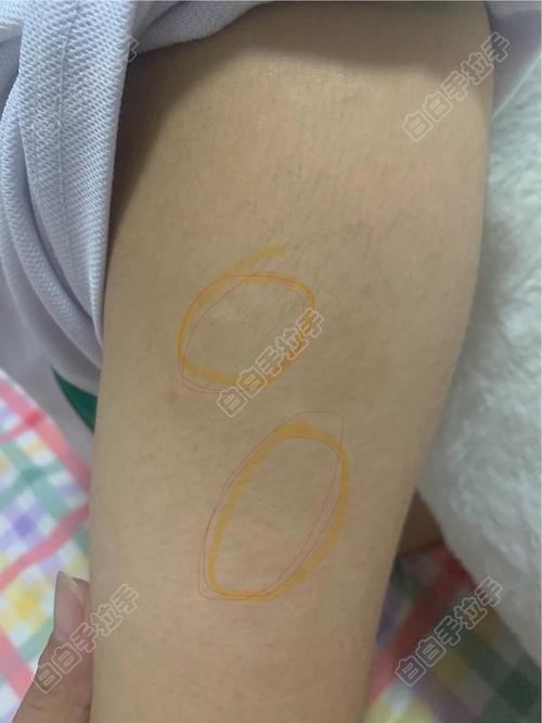 黄忆慈考上什么大学了 黄忆慈考上什么大学了