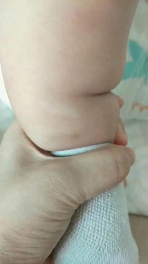 泛发型白癜风治疗医院 泛发型白癜风治疗医院