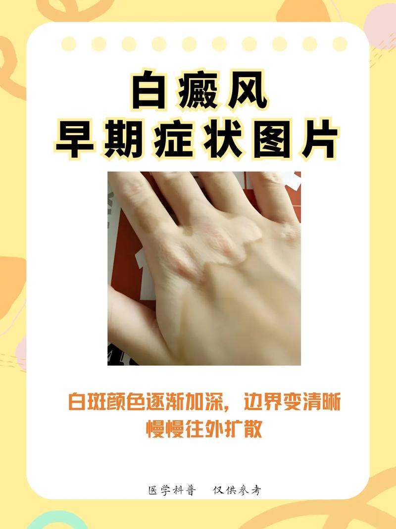 ʲôԭ��������� �ٷ����ư��絽�����