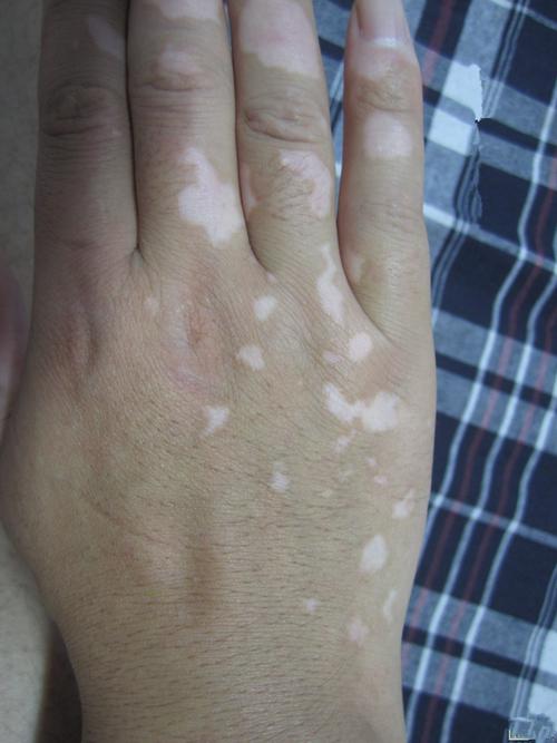 ͷƤ���˰��� ͷƤ���˰������κ���