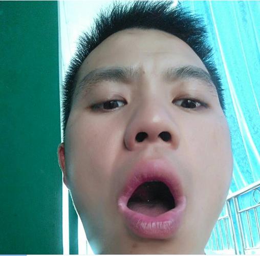 中医治白癜风的好处 中医治疗白癜风有什么特效药提供一下 中医治白癜风的好处 中医治疗白癜风有什么特效药提供一下