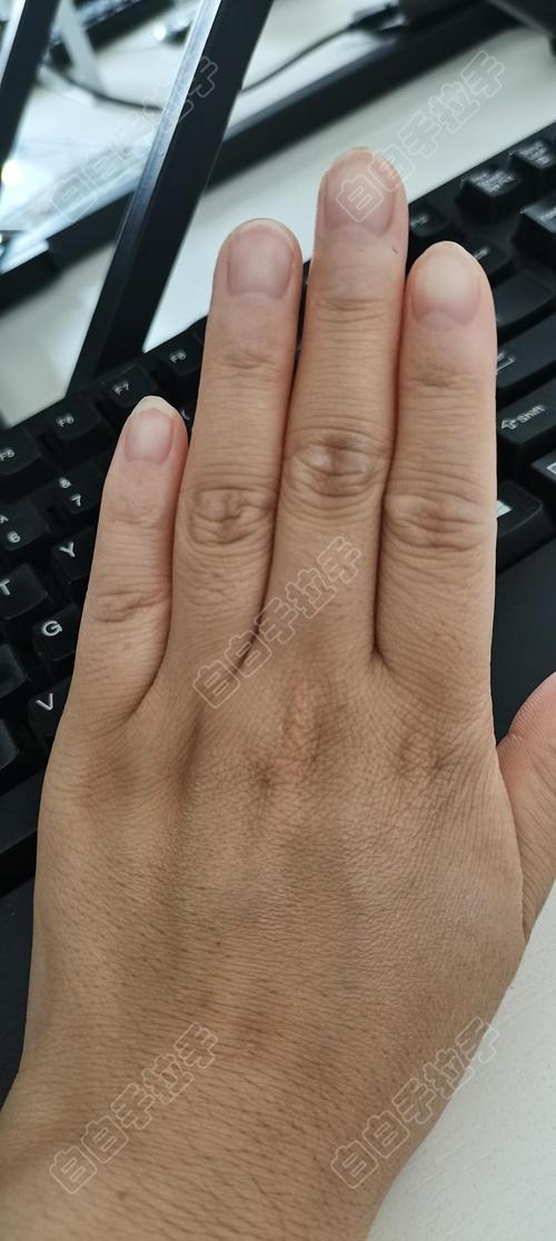 ɽưרҽԺ 沿ưҪ೤ʱ