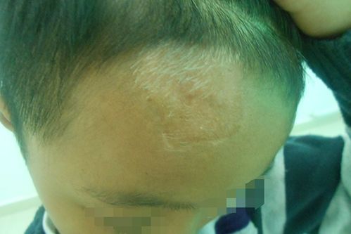 ��������ҽԺ���ư���