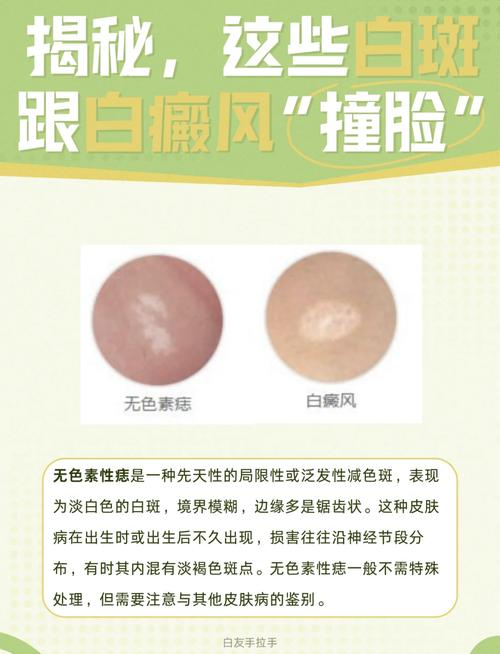 ˮ������ˮ(ˮ������ˮ��������)