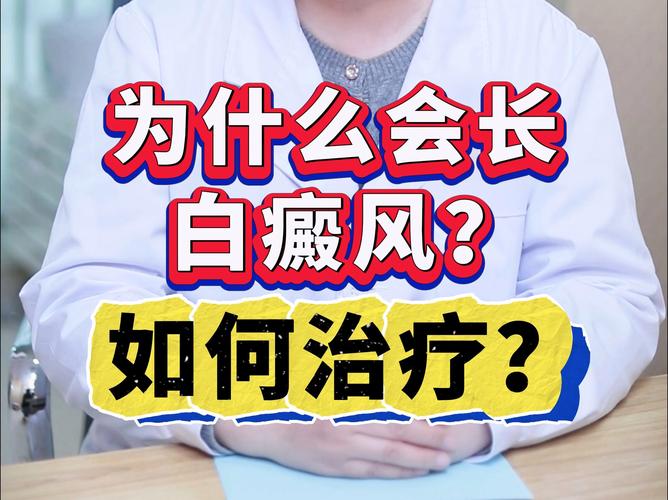 小儿白癜风能治好吗 邯郸治疗白癜风哪 小儿白癜风能治好吗 邯郸治疗白癜风哪