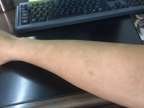 �����ʲôʳ��� �����ļ�ҽԺ�ΰ����