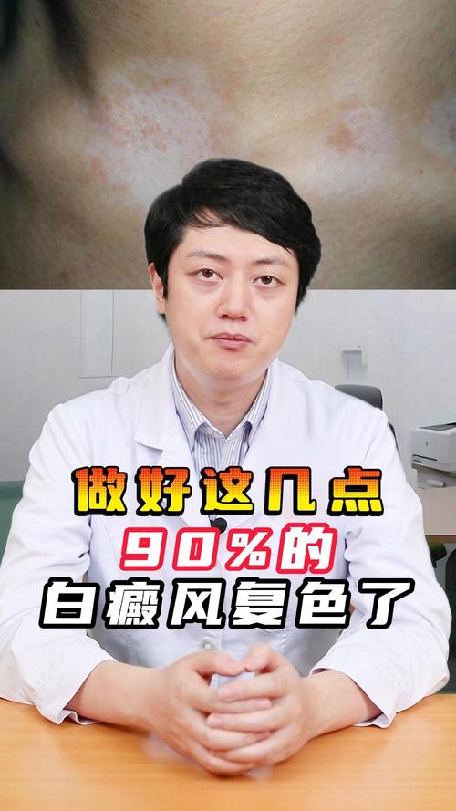 白癜风食物拍照穿搭 白癜风饮食食谱 白癜风食物拍照穿搭 白癜风饮食食谱