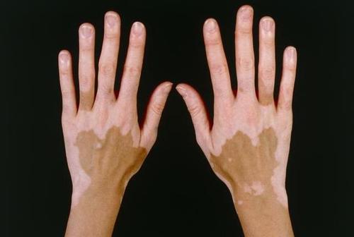 ����İװ���������