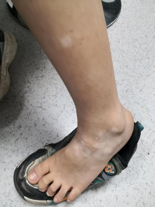 ʮ������ �������ư���ҽԺ�ļҺ��������а������׸������������ЩΣ��