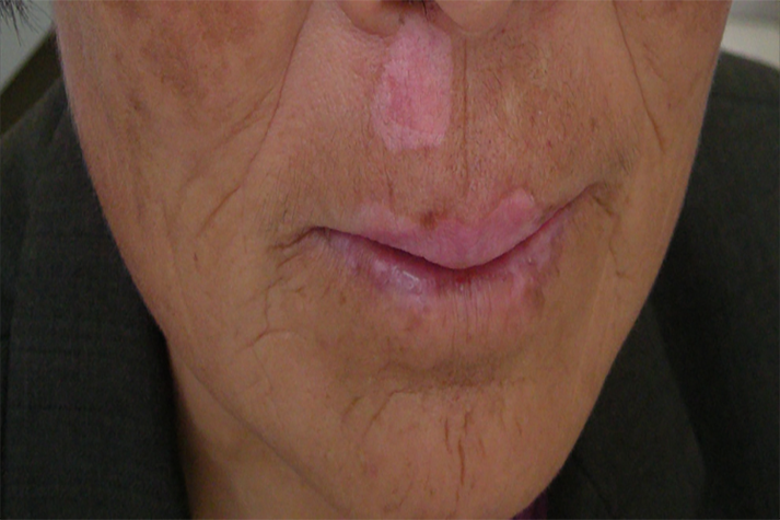 ���综�߲���̫����ɹ