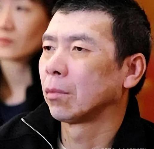 治疗白癜风有用的药膏 治疗白癜风有用的药膏