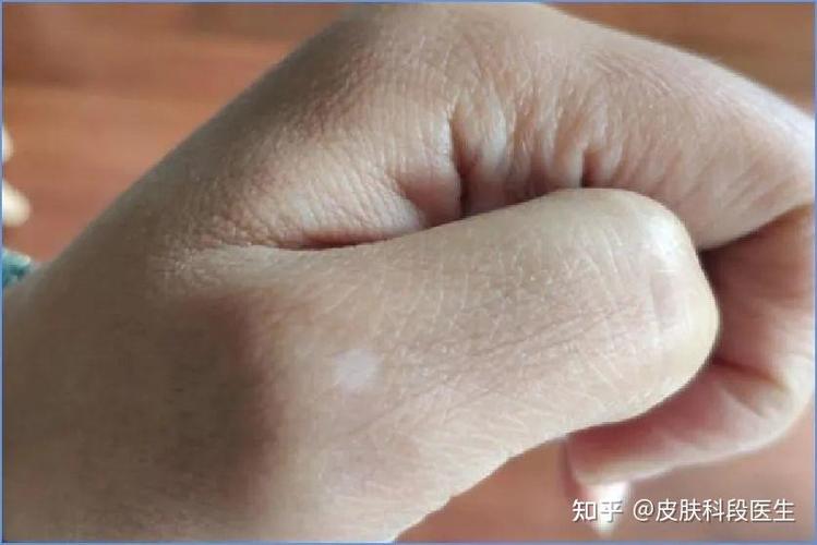 �ɶ��������ĸ�ҽԺ�� ����Щ�������Լ��ٰ�����ɵ��˺�