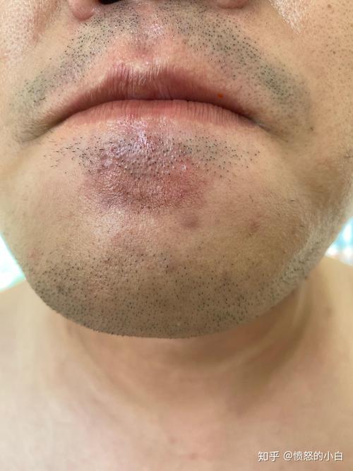 ɳΰҽԺĸרҵ ϴʱӦעʲô