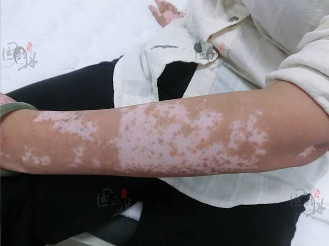 ����ŵ˹ ����ŵ˹Сè