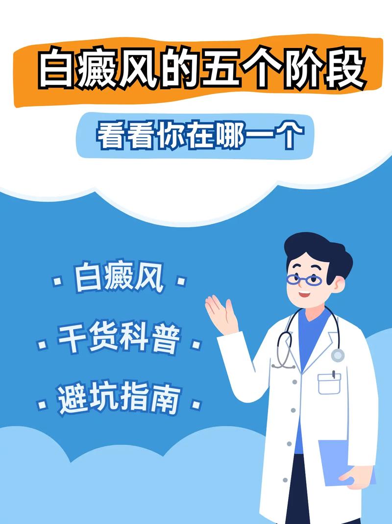 白癜风的几种病发因素 白癜风的几种病发因素