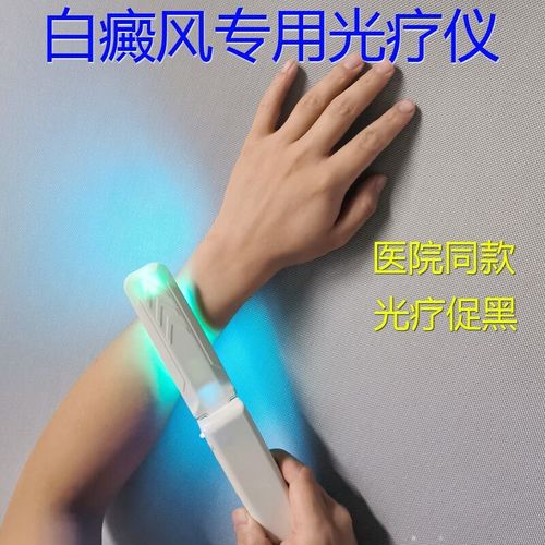 广东治疗白癜风 广东治疗白癜风