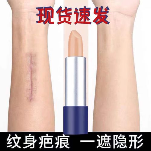 湛江治白癜风的医院哪个专业 应用激素治疗白癜风应注意哪些问题 湛江治白癜风的医院哪个专业 应用激素治疗白癜风应注意哪些问题