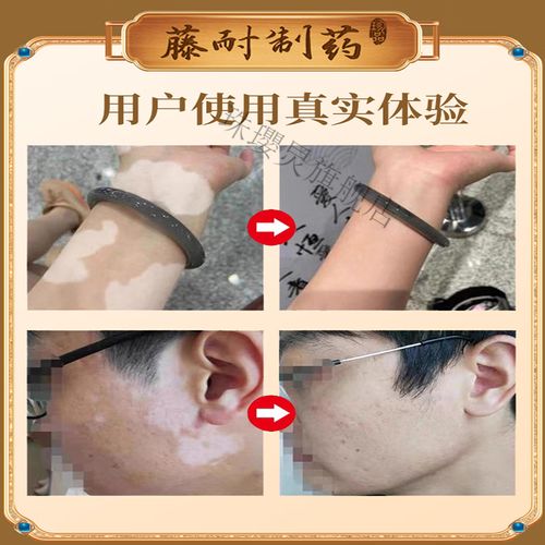 ���粻�ܳ�ʲô �ں�����������ư���