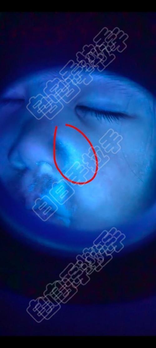 Ⱦ�ϼ��� Ⱦ�ϼ���ȥ��Ѫ˿�۸�