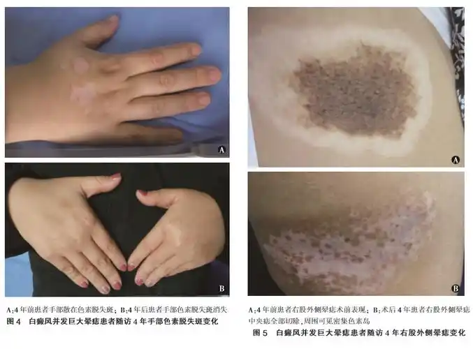 �����ǲ��ǻᴫȾ �Ž��ΰ���ҽԺ�ĺ�