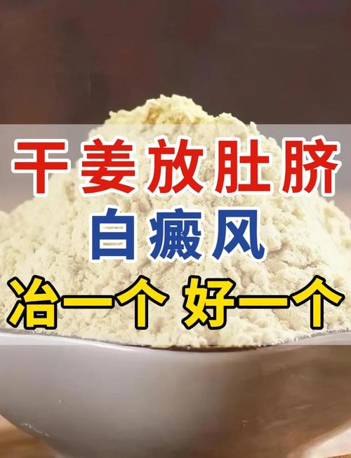 广州医院看皮肤病怎么样影响白癜风的五大因素 广州医院看皮肤病怎么样影响白癜风的五大因素