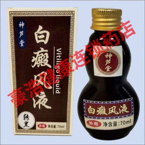 成都治白癜风好的医院 白癜风易患人群有哪些 成都治白癜风好的医院 白癜风易患人群有哪些