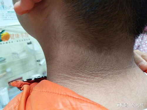 ���综�߳Ժܶ�����