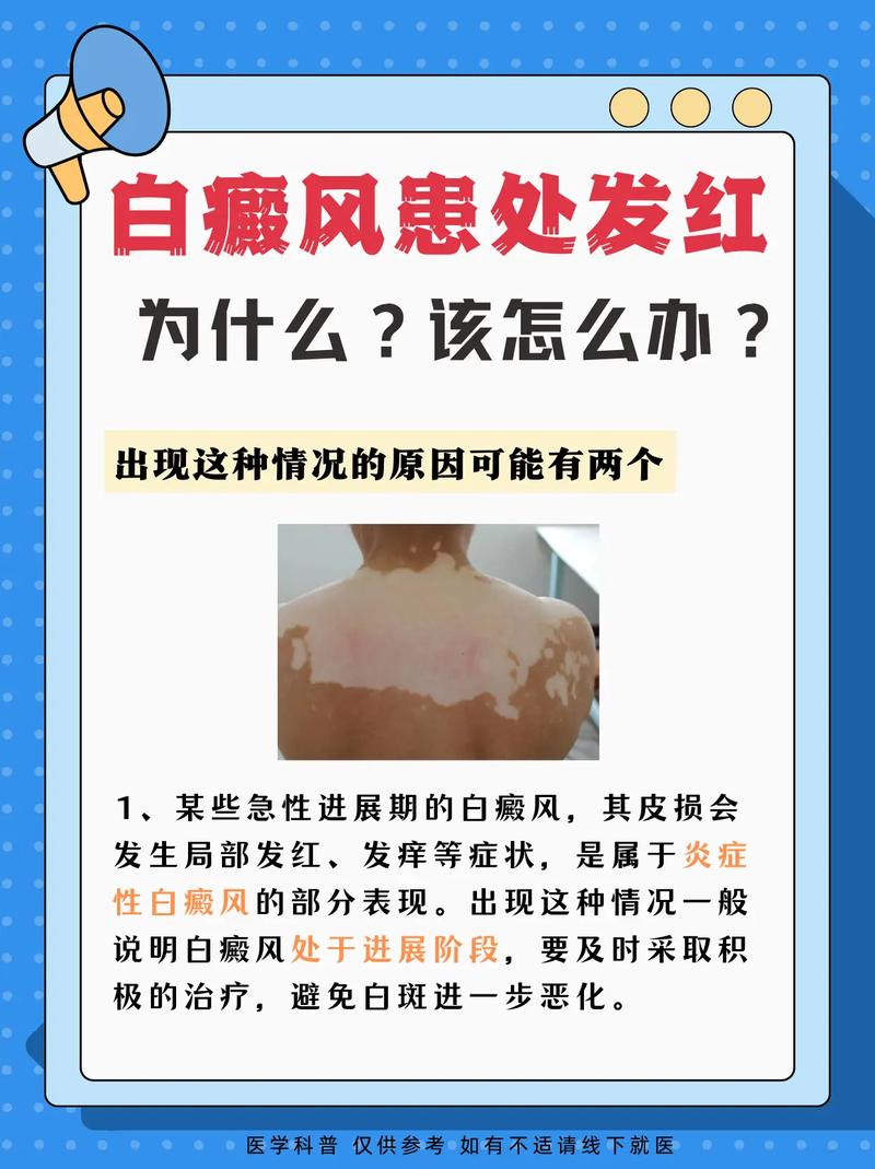 ɢ���Ͱ�������������� �����ΰ����ĸ�ҽԺ��