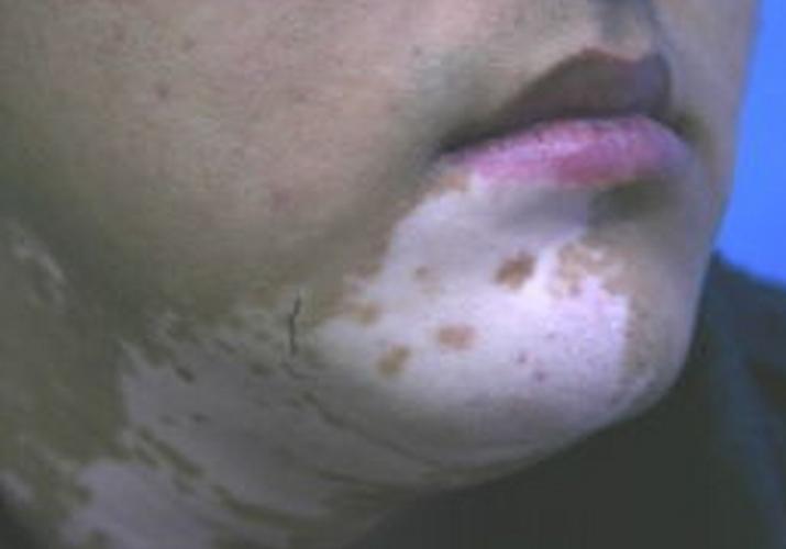 �߶ȹ�ע ��ɽ����ҽԺ�ļҺ�ҽԺ��ע�����԰�����θ�������