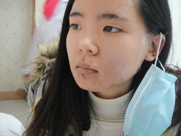 ɽ���������������