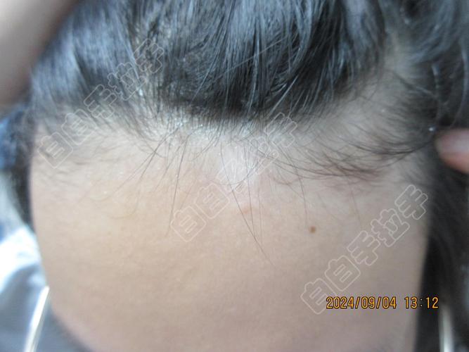 Ӣ�����Է��� Ӣ�����Է������籭